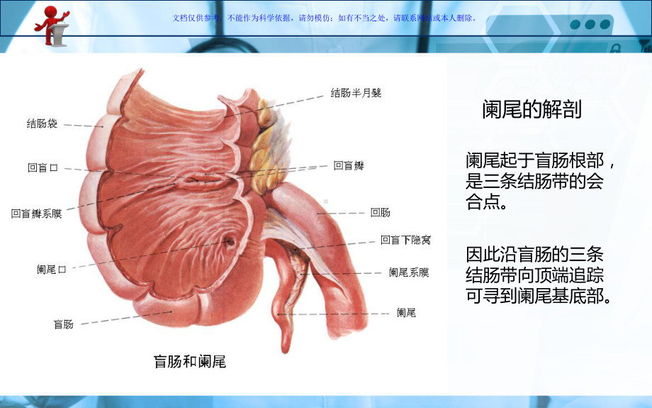 急性阑尾炎病人的护理查房课件.ppt_第2页