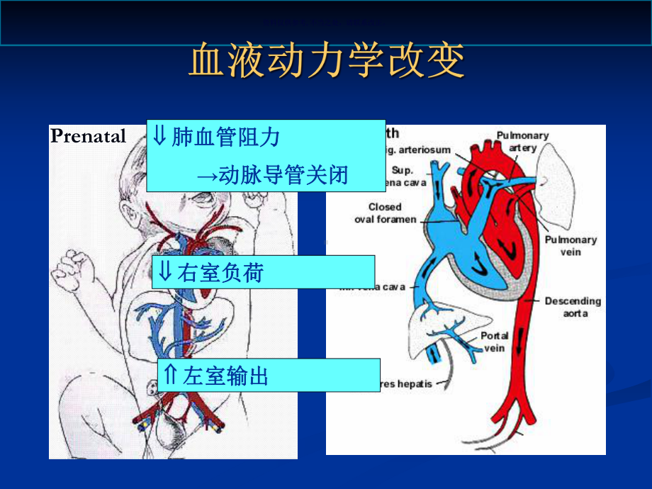 早产儿动脉导管开放课件.ppt_第2页