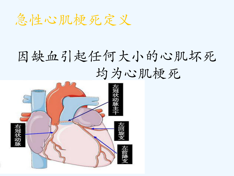 急性心肌梗死的溶栓治疗教学查房课件.ppt_第2页