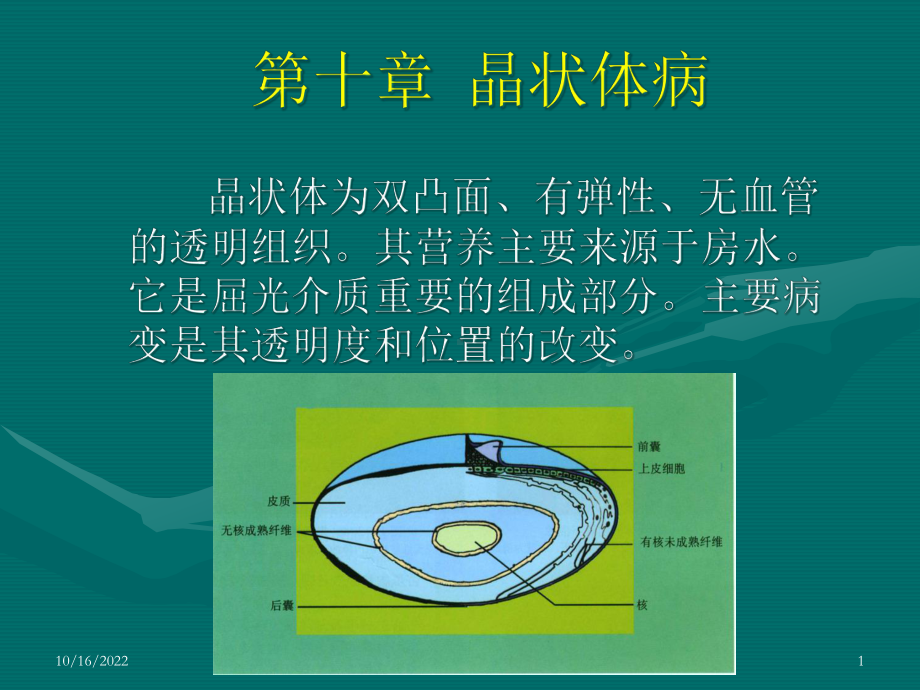 晶状体病课件.ppt_第1页