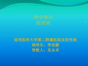 教学查房银屑病课件.ppt