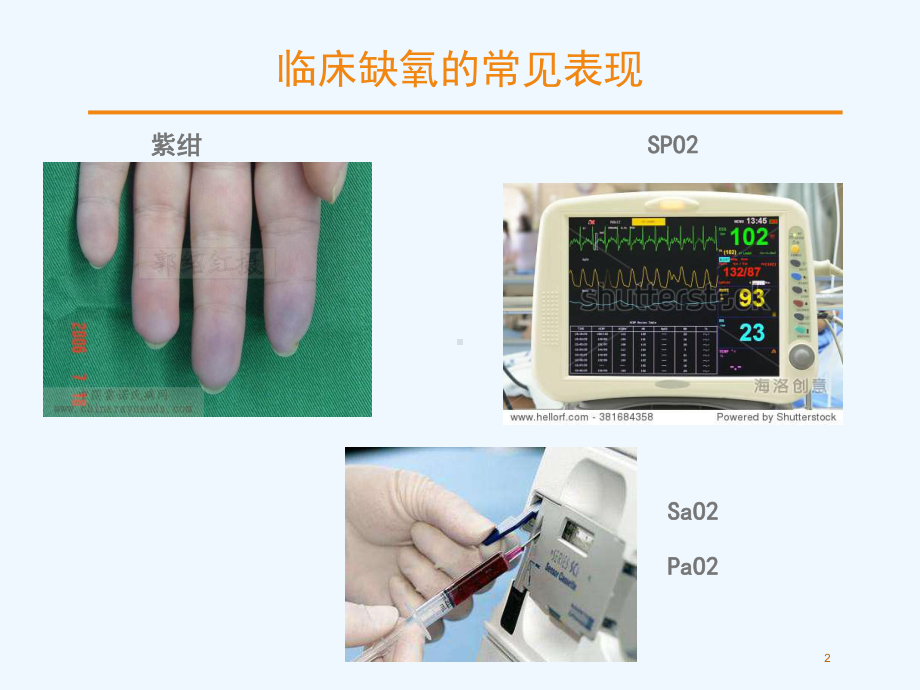 心力衰竭低氧血症课件.ppt_第2页