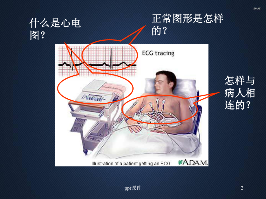 心电图的基础知识-课件.ppt_第2页