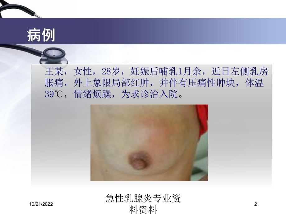 急性乳腺炎专业培训课件.ppt_第2页