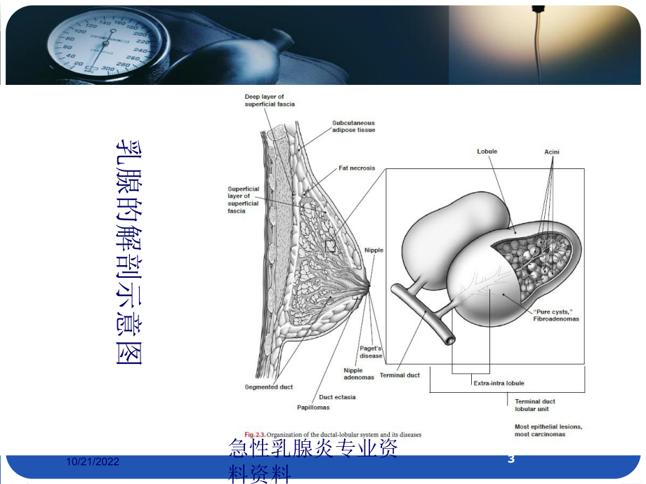 急性乳腺炎专业培训课件.ppt_第3页