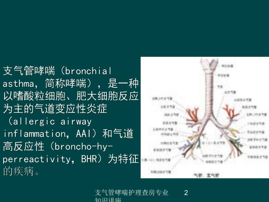 支气管哮喘护理查房专业知识讲座培训课件.ppt_第2页