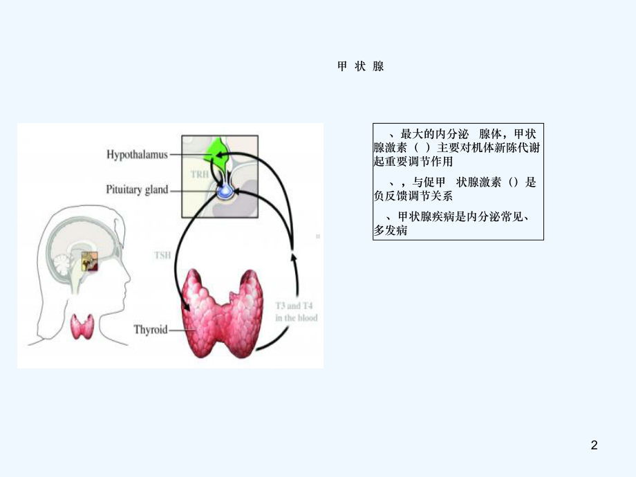 常见甲状腺疾病诊疗要点课件.ppt_第2页