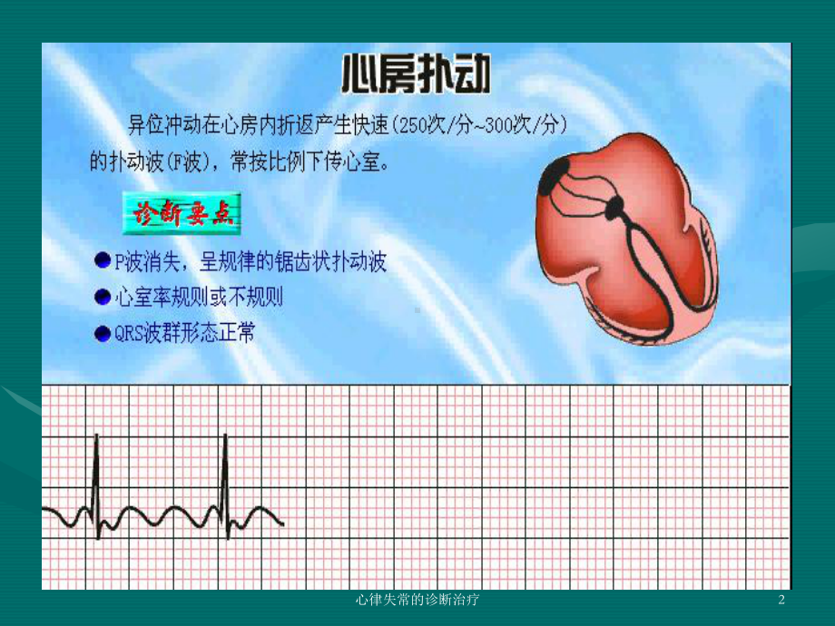 心律失常的诊断治疗课件.ppt_第2页