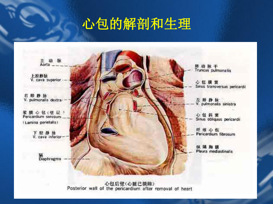 急性心包炎专题宣讲培训课件.ppt_第3页