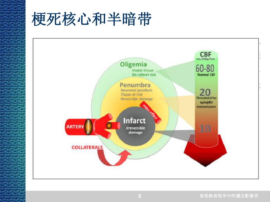 急性缺血性卒中的灌注影像学课件.ppt_第2页