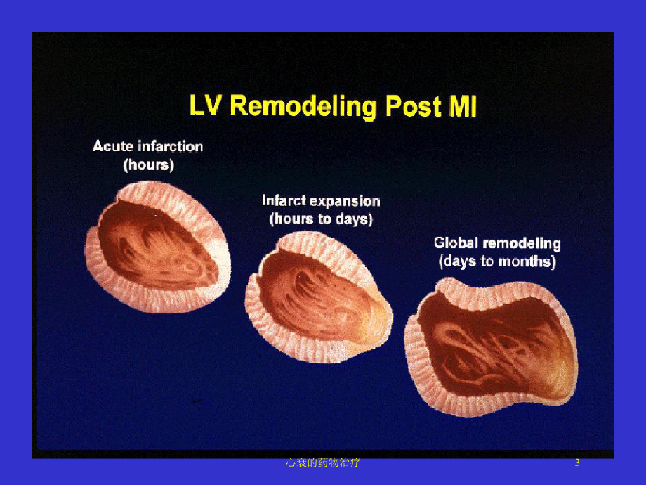 心衰的药物治疗培训课件.ppt_第3页