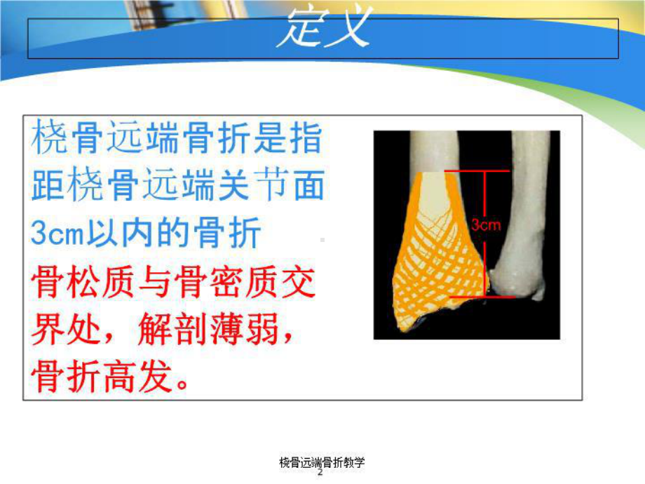 桡骨远端骨折教学培训课件.ppt_第2页