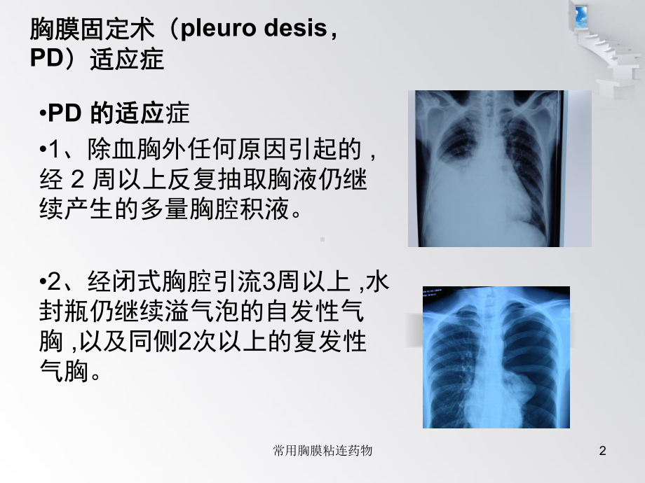 常用胸膜粘连药物培训课件.ppt_第2页