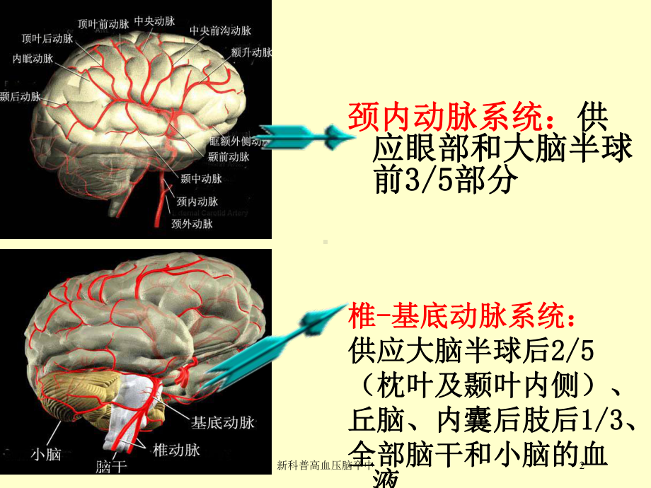 新科普高血压脑卒中培训课件.ppt_第2页