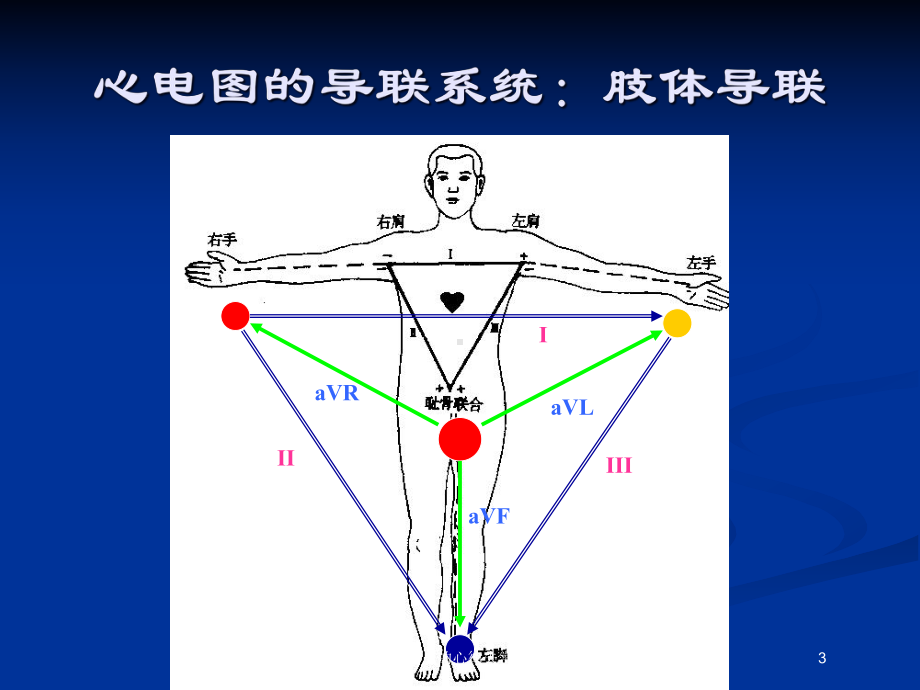 常见的心律失常培训课件.ppt_第3页