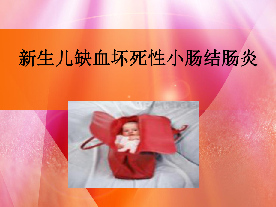 新生儿缺血坏死性小肠结肠炎课件.pptx_第1页