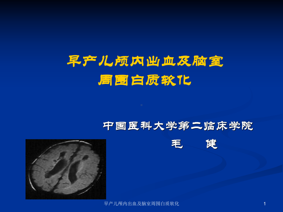 早产儿颅内出血及脑室周围白质软化课件.ppt_第1页