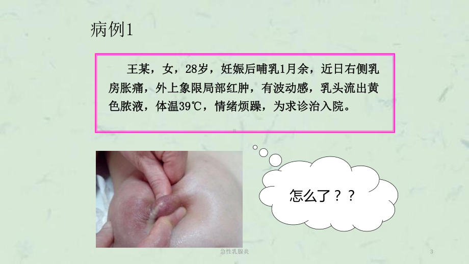 急性乳腺炎课件.ppt_第3页