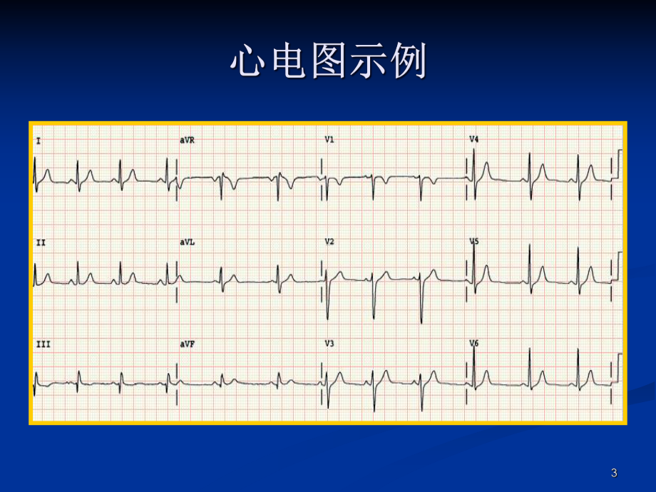 心电图基础知识详解课件.pptx_第3页