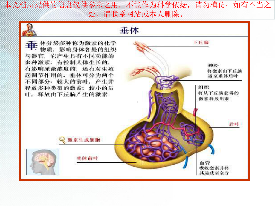 席汉氏综合征讲解医疗培训课件.ppt_第2页