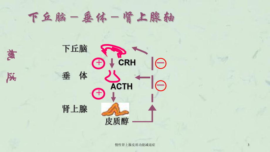 慢性肾上腺皮质功能减退症课件.ppt_第3页