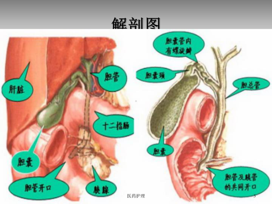 急性梗阻性化脓性胆管炎的护理(医疗知识)课件.ppt_第3页