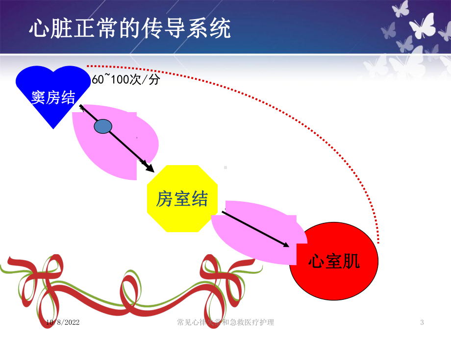 常见心律失常和急救医疗护理课件.ppt_第3页