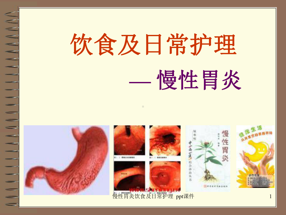 慢性胃炎饮食及日常护理-课件.ppt_第1页