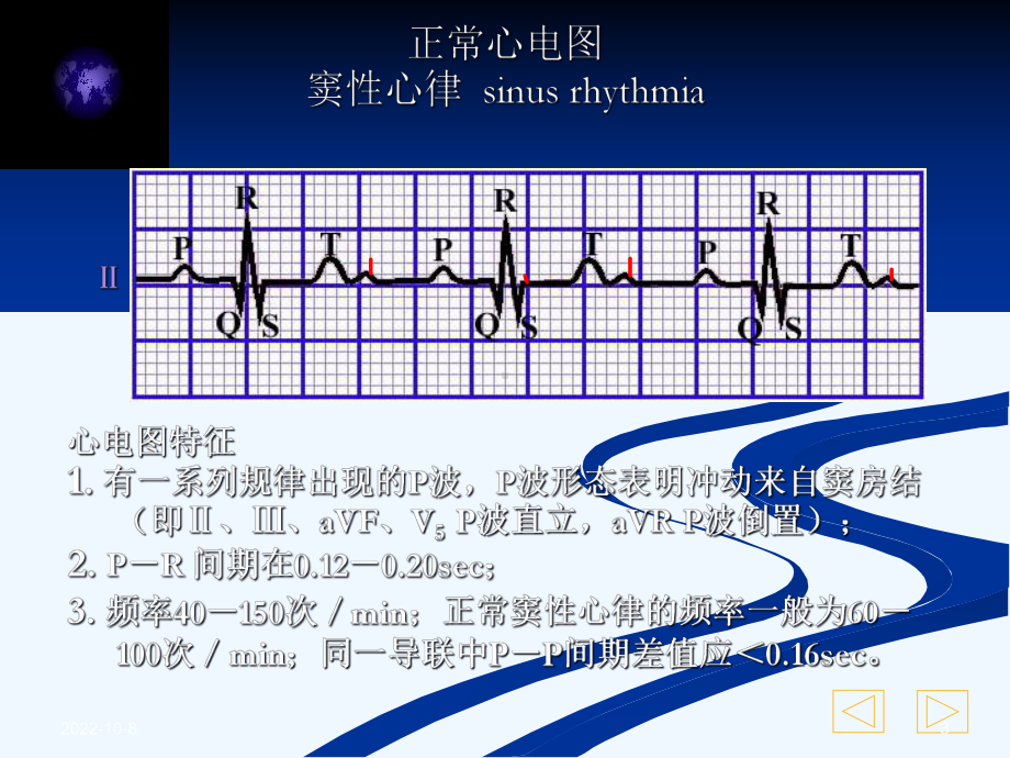 急诊心电图识别精要课件.ppt_第3页