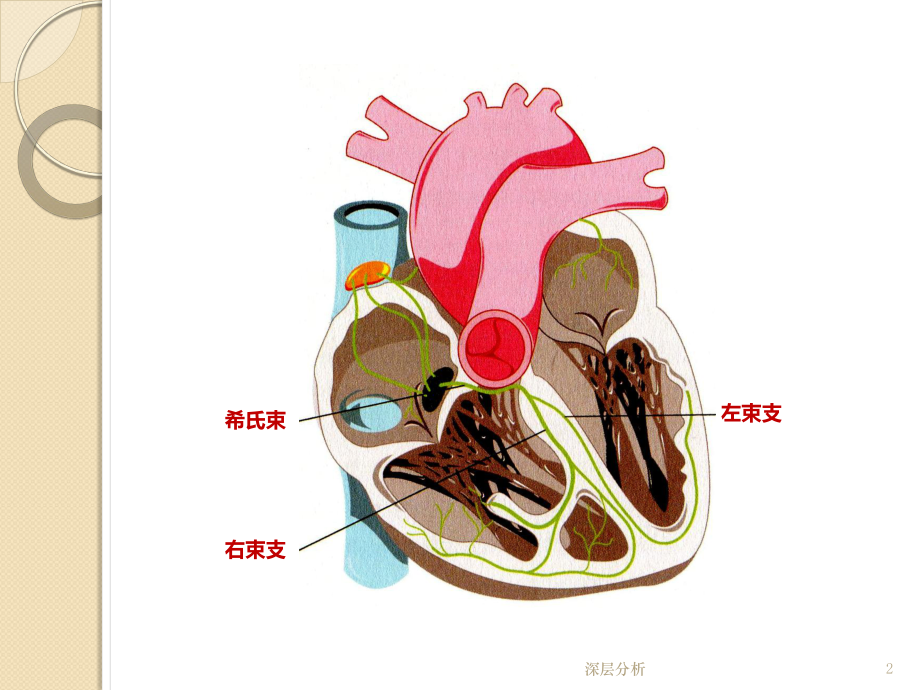 心室除极波及室内传导阻滞课件.ppt_第2页