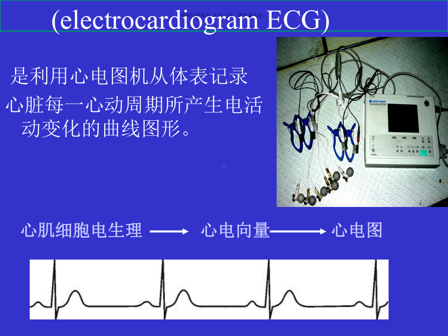 心电图基础知识讲座课件.ppt_第3页