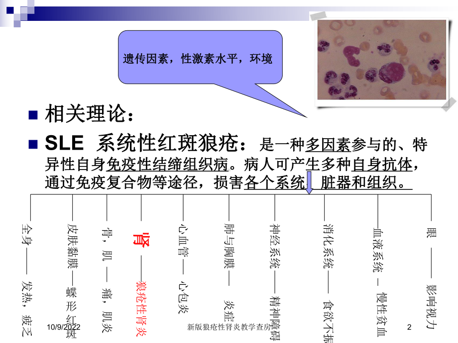 新版狼疮性肾炎教学查房培训课件.ppt_第2页