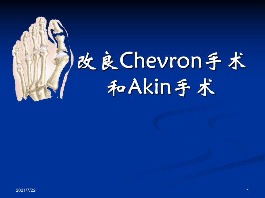 改良CHEVRON手术和AKIN手术课件.ppt_第1页