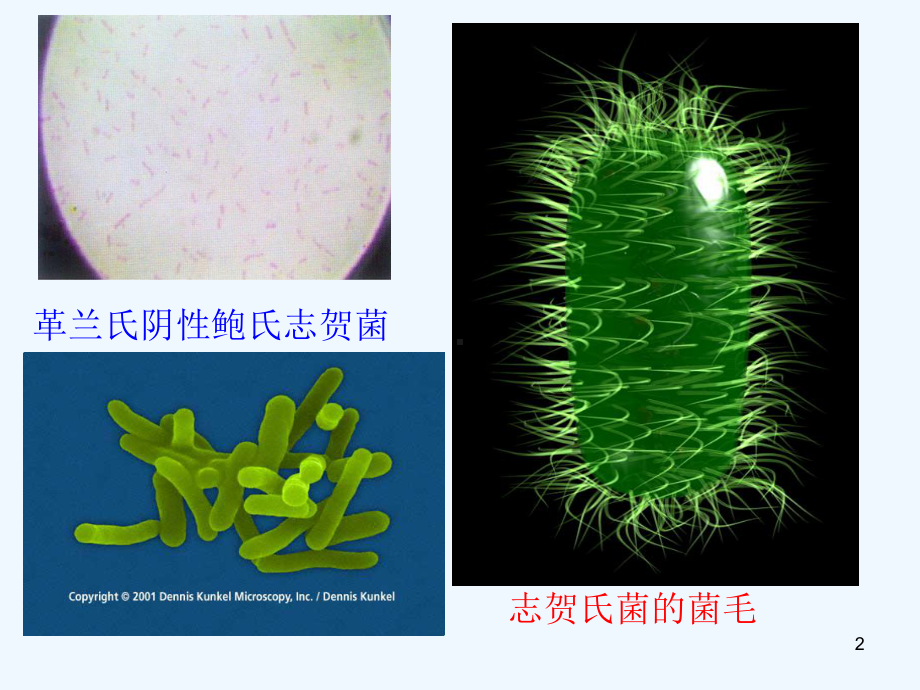 志贺氏菌和致泻大肠埃希式菌的检验课件.ppt_第2页