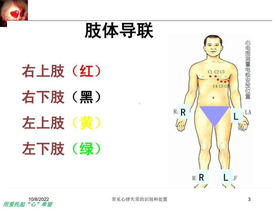 常见心律失常的识别和处置课件.ppt_第3页