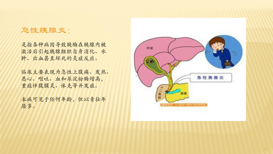 急性胰腺炎的临床表现课件.pptx_第2页