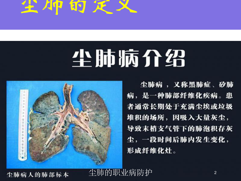 尘肺的职业病防护培训课件.ppt_第2页