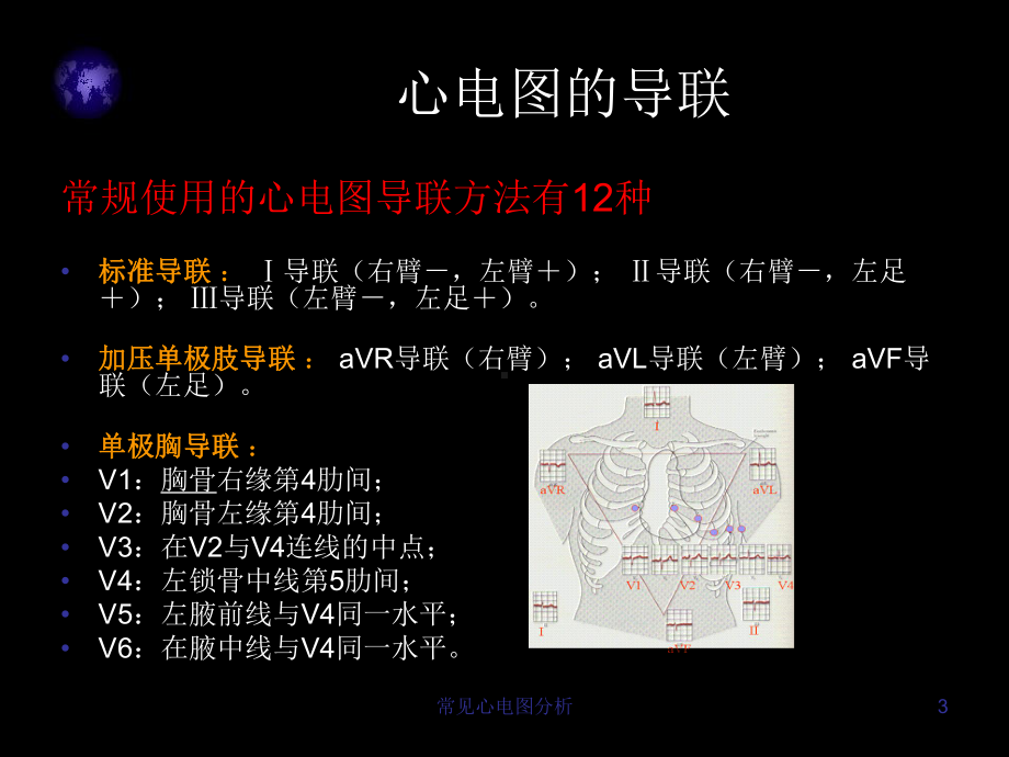 常见心电图分析课件.ppt_第3页