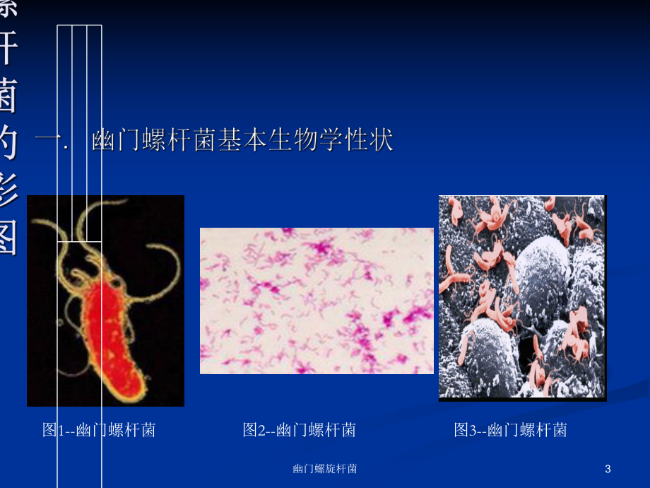 幽门螺旋杆菌培训课件.ppt_第3页