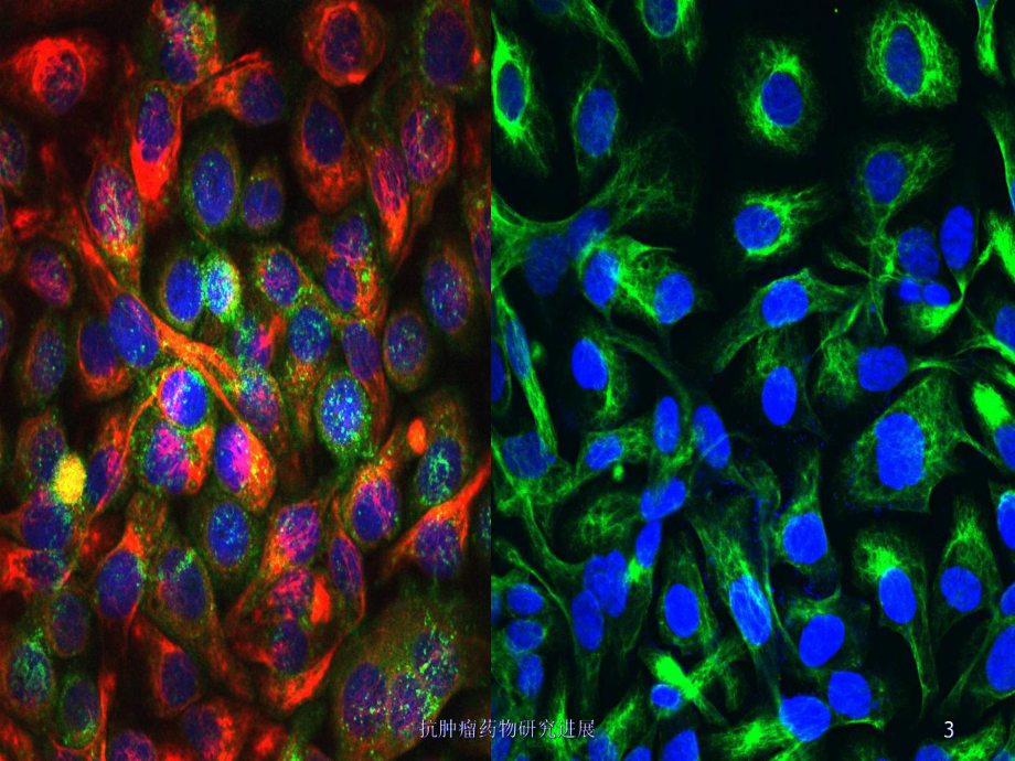 抗肿瘤药物研究进展培训课件.ppt_第3页