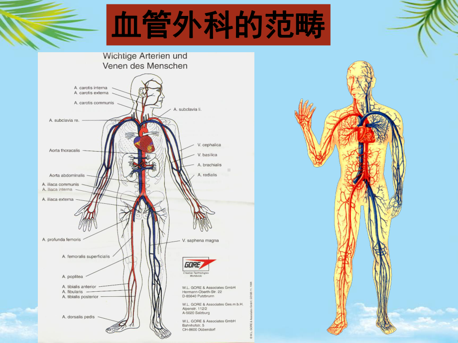 教培用血管外科常见疾病课件.ppt_第3页