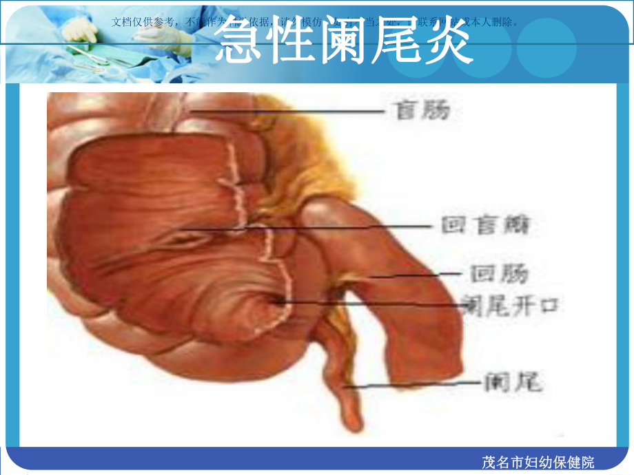 急性阑尾炎知识讲座课件.ppt_第3页