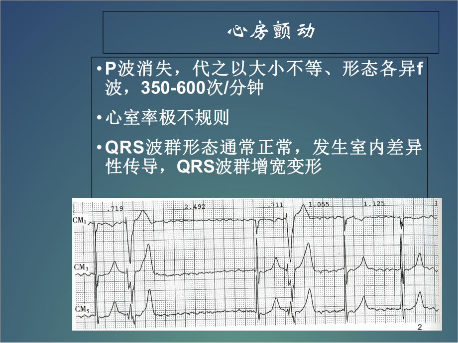 房扑与房颤心电图医学课件.ppt_第2页