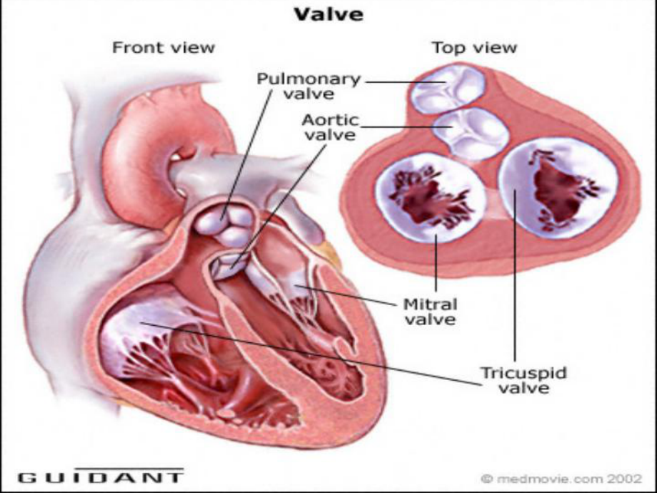 心脏瓣膜病版课件.ppt_第3页