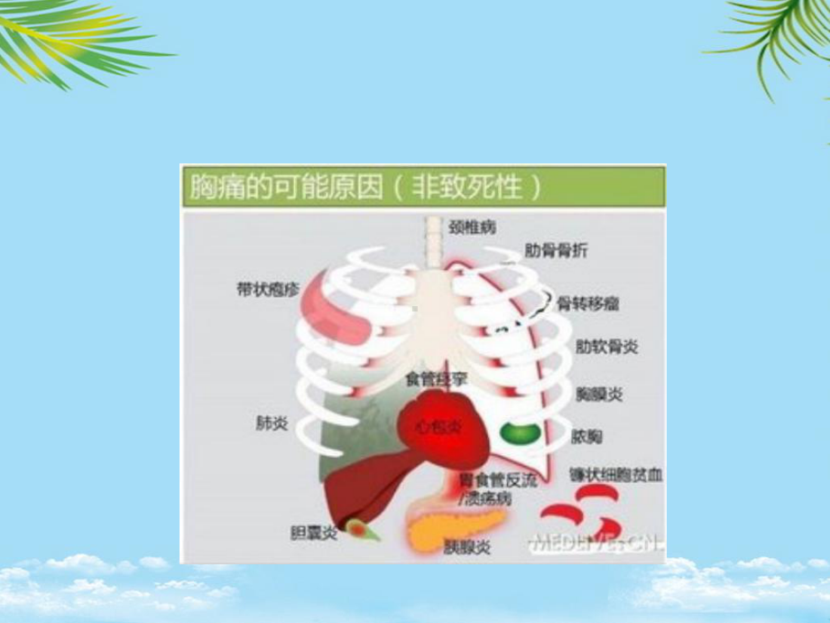 教培用诊断学胸腹头痛课件.ppt_第3页