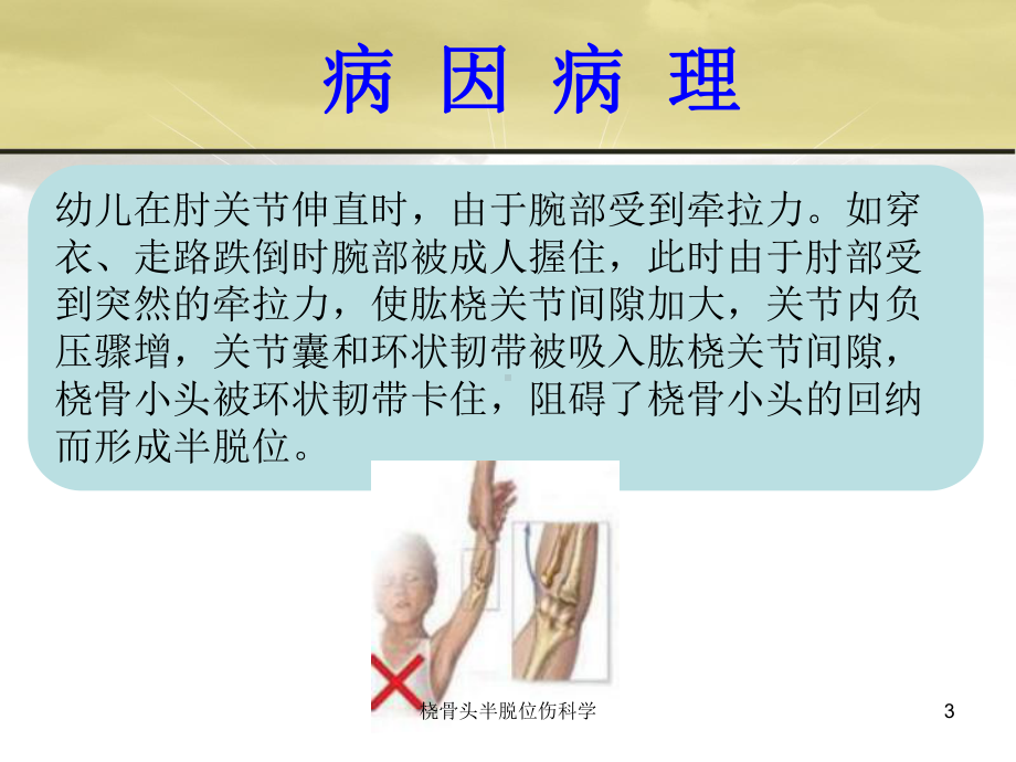 桡骨头半脱位伤科学培训课件.ppt_第3页