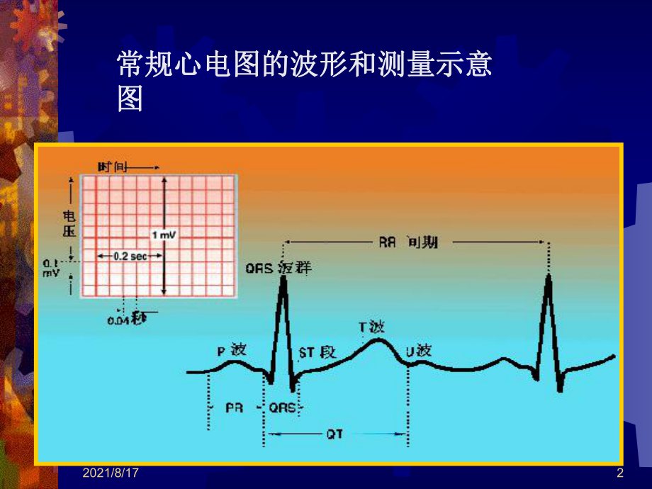 心电图的诊断和分析课件.ppt_第2页