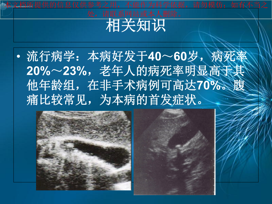 急性化脓性胆管炎医疗护理查房培训课件.ppt_第3页