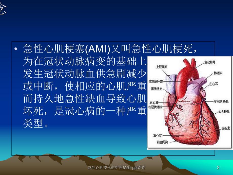 急性心肌梗死的护理措施-课件.ppt_第2页