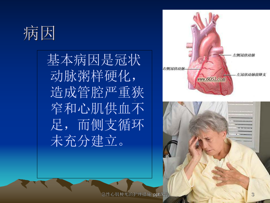 急性心肌梗死的护理措施-课件.ppt_第3页